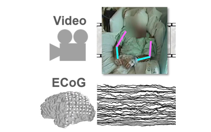 AJILE Movement Prediction: Multimodal Deep Learning for Natural Human Neural Recordings and Video